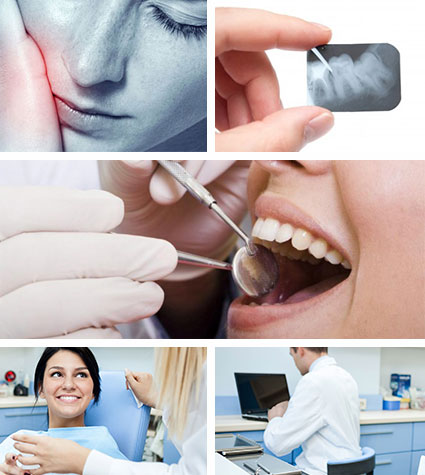 Terapia endodontica | Devitalizzazione dente | Endodonzia