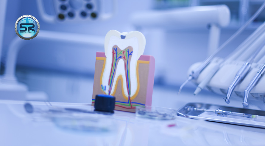 Devitalizzazione del dente | devitalizzare un dente