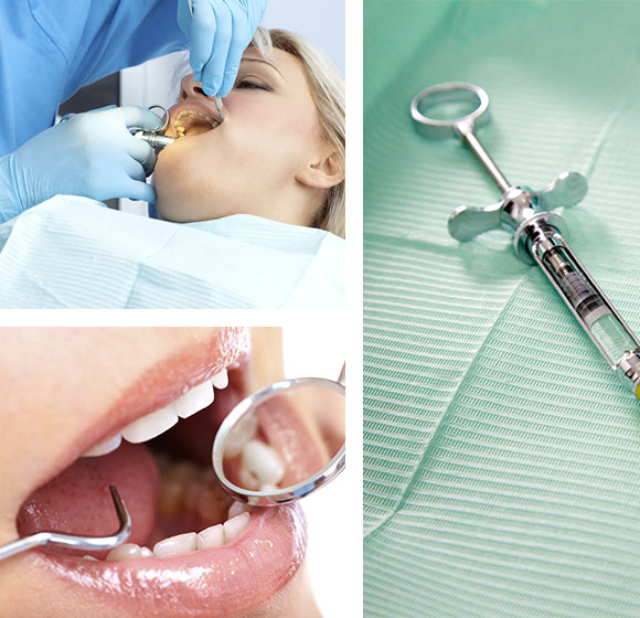 Implantologia Chieti | Posizionamento impianti dentali