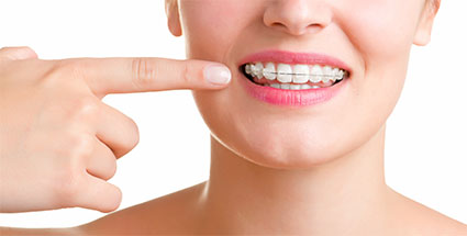 Ortodonzia invisibile | Trattamenti ortodontici