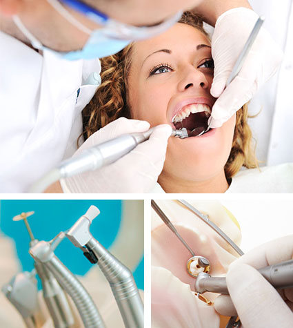 Devitalizzazione dente | Otturazioni