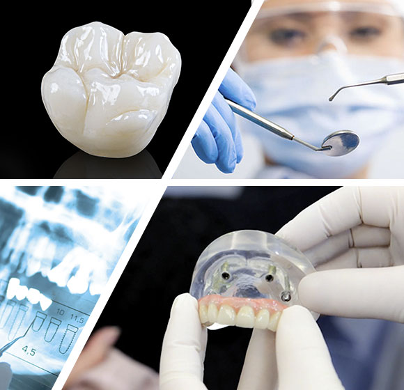 Installazione protesi dentarie fisse | Mobili